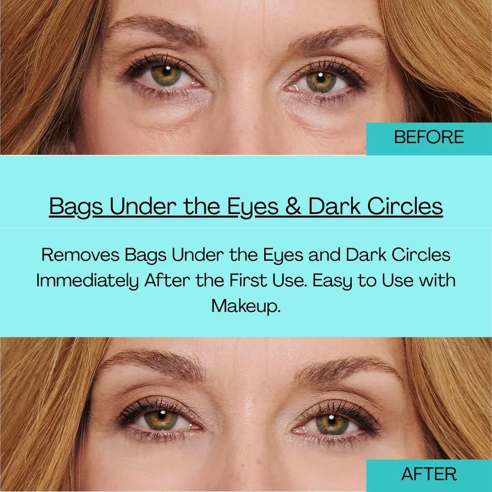 Final 3 Hours: 60%OFF🔥 Instant Eye Tightener Easy
