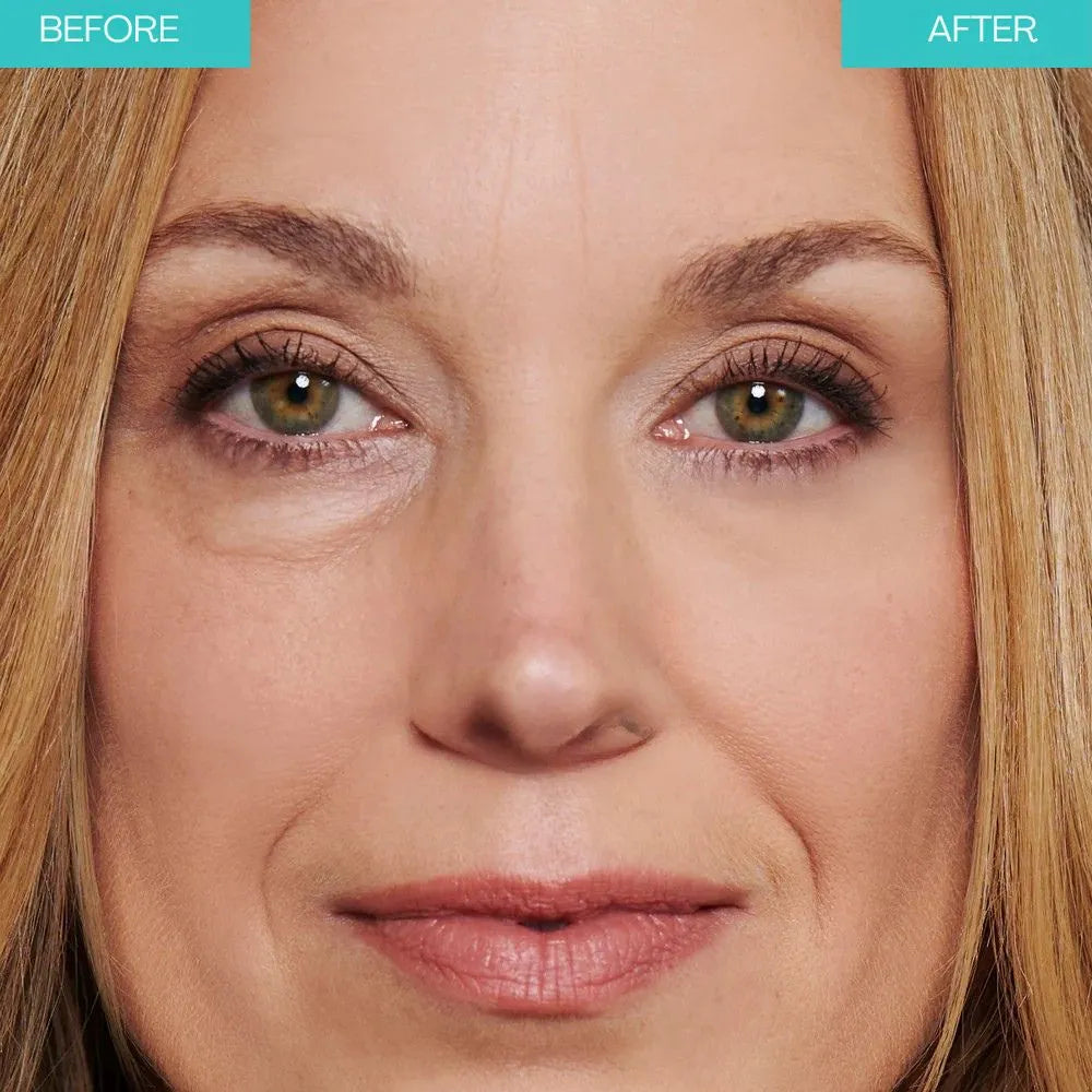 Final 3 Hours: 60%OFF🔥 Instant Eye Tightener Easy