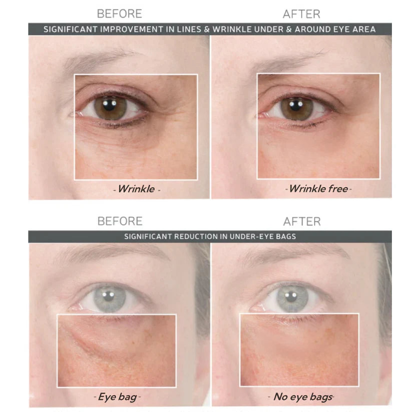 Final 3 Hours: 60%OFF🔥 Instant Eye Tightener Easy