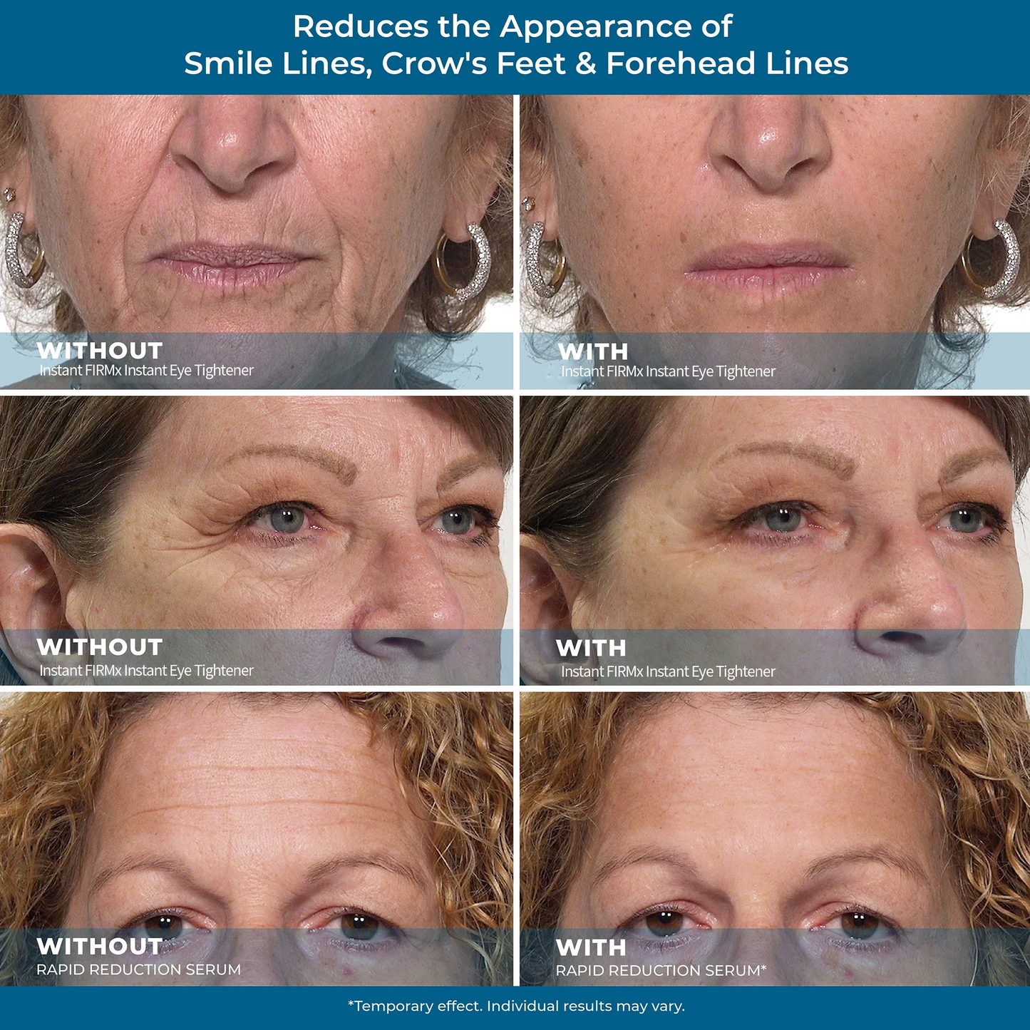 Final 3 Hours: 60%OFF🔥 Instant Eye Tightener Easy