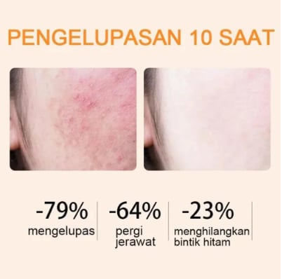 Orange Enzyme Exfoliating Gel🍊The Gentle Miracle Your Skin Has Been Crying Out For