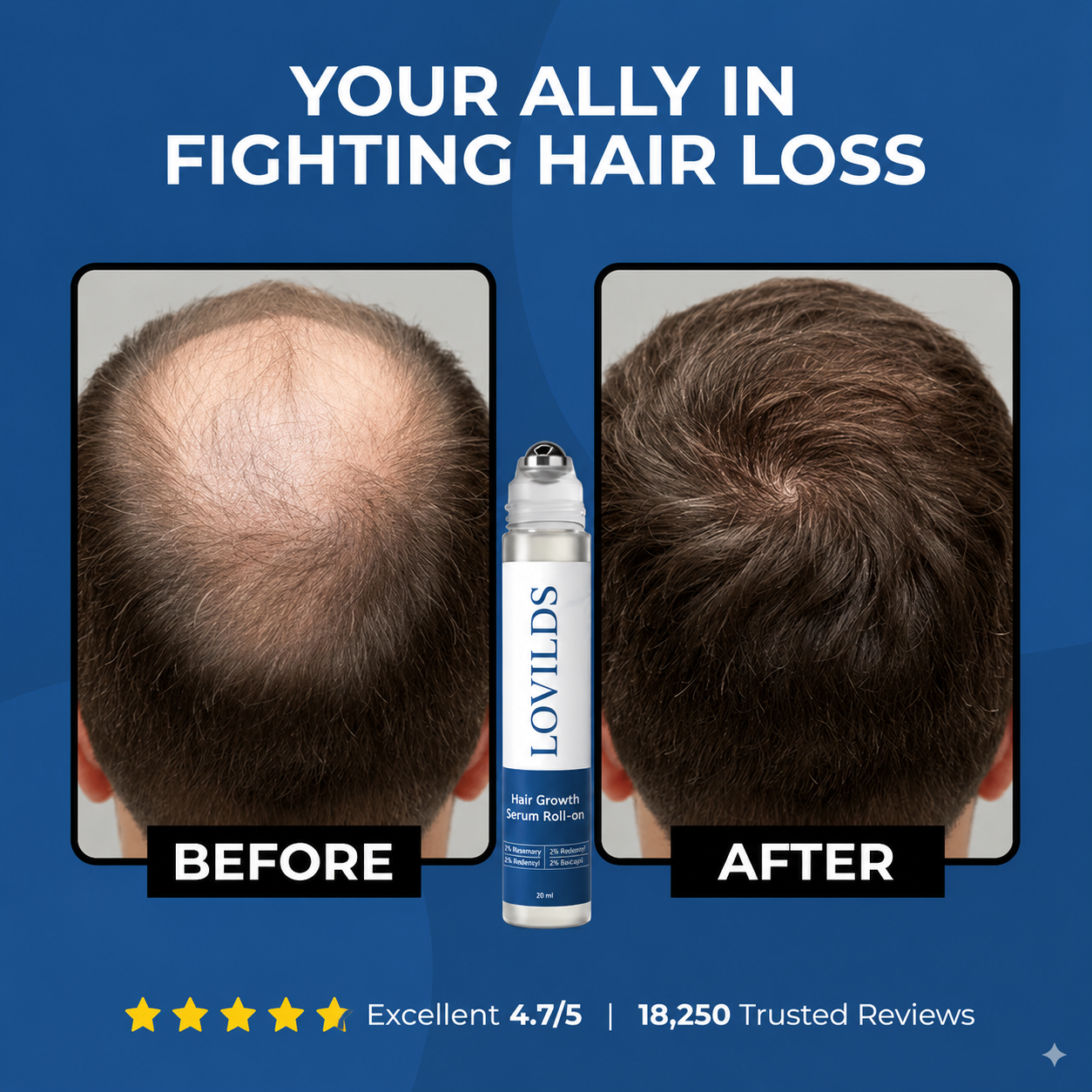 LOVILDS® Hair Growth Roll-On Serum — Combat Thinning & Promote Thicker, Fuller Hair
