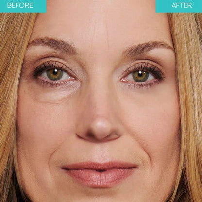 Final 3 Hours: 60%OFF🔥 Instant Eye Tightener Easy