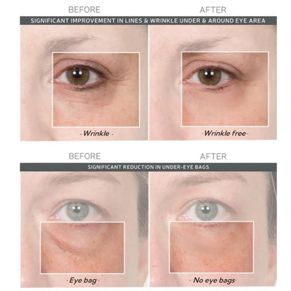 Final 3 Hours: 60%OFF🔥 Instant Eye Tightener Easy