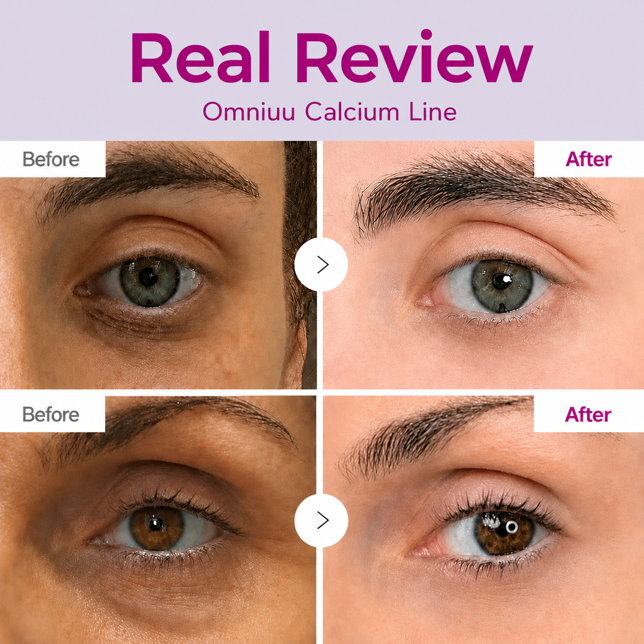 🔥LAST DAY 50% OFF!!Omniuu® Korean Calcium Dark Spot Eye Cream