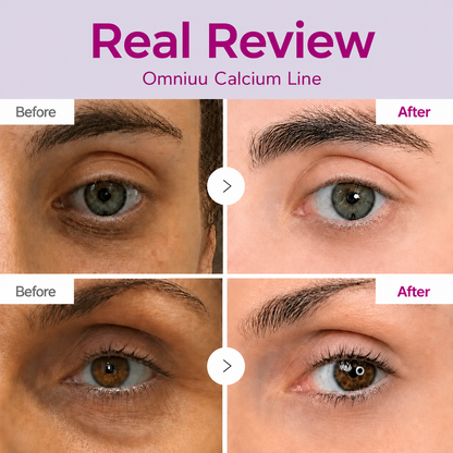 🔥LAST DAY 50% OFF!!Omniuu® Korean Calcium Dark Spot Eye Cream