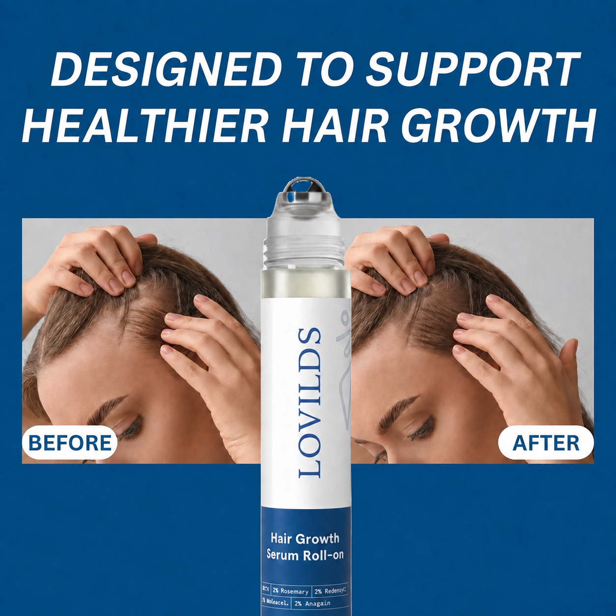 LOVILDS® Hair Growth Roll-On Serum — Combat Thinning & Promote Thicker, Fuller Hair