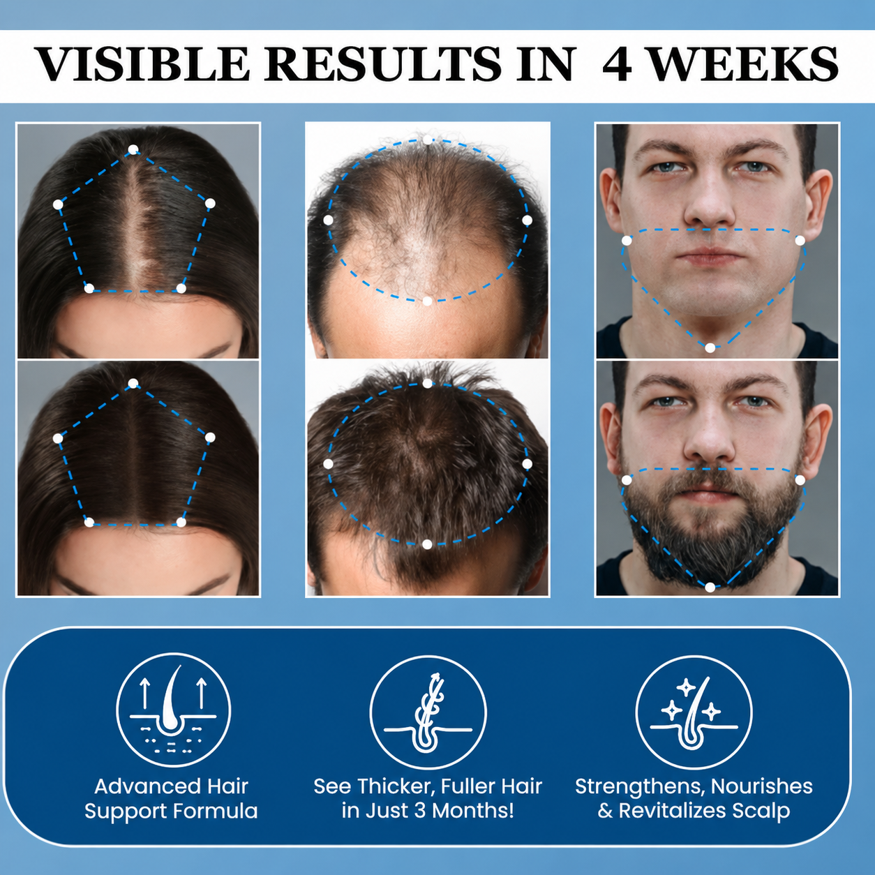 LOVILDS® Hair Growth Roll-On Serum — Combat Thinning & Promote Thicker, Fuller Hair