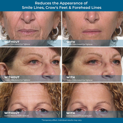 Final 3 Hours: 60%OFF🔥 Instant Eye Tightener Easy