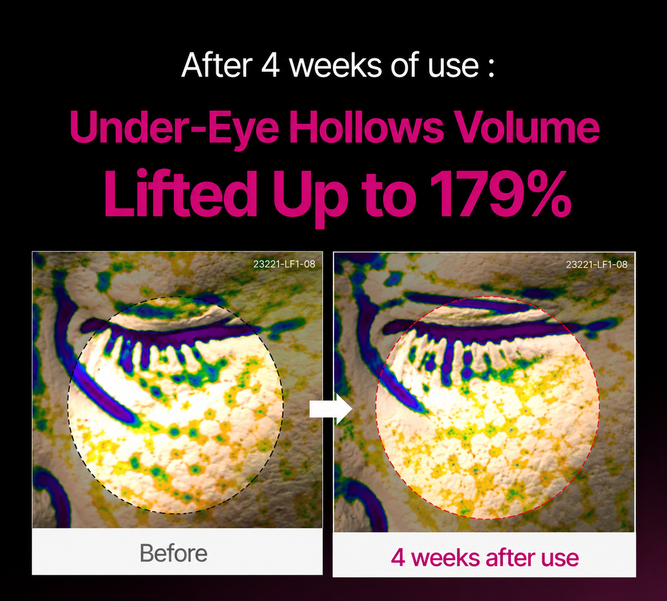 🔥LAST DAY 50% OFF!!Omniuu® Korean Calcium Dark Spot Eye Cream